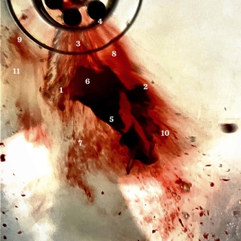 Расстройство - 1 и 5 (Speed Up)