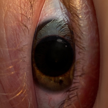 Минаева, Hostro, Anton Abramov - Шоколадка (Hostro and Anton Abramov Remix) (2024)