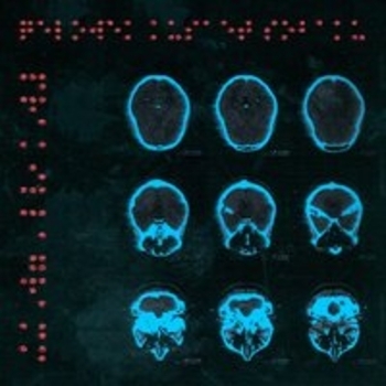 Альбом Человек кусает собаку Pra(Killa'Gramm)