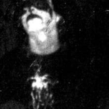 Cruel - Я болен