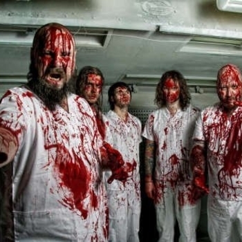 General Surgery - Exotoxic Septicity