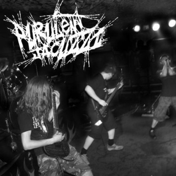 Purulent Jacuzzi - Your Baby Has An Asthma...So Would You Like To Smoke